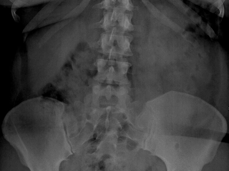 RX - Esqueleto (Incidencias Adicionais Básicas de: Crânio, Coluna, Bacia e Membros)