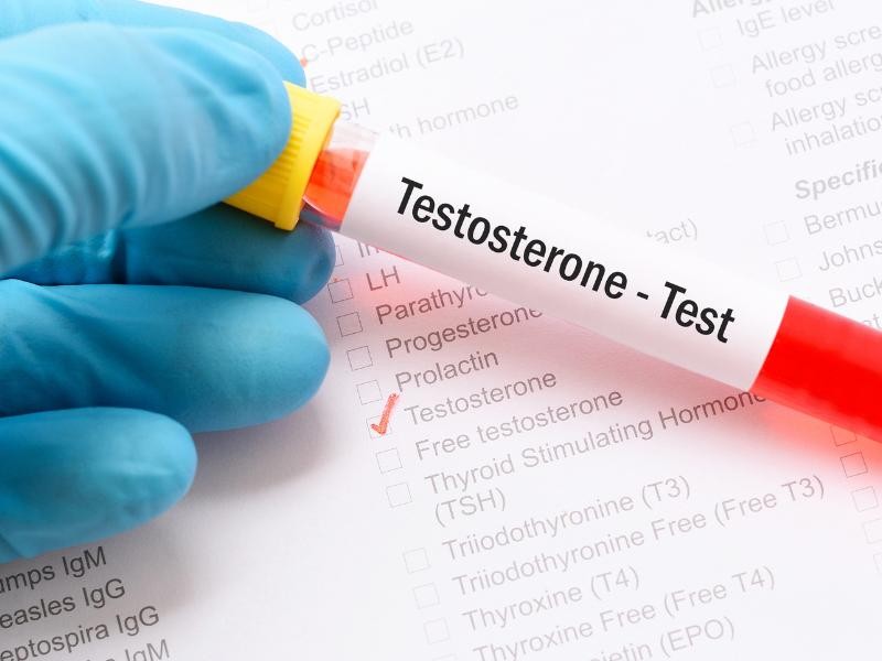 Testosterona Total