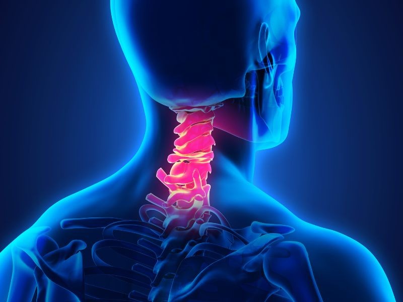 Ecodoppler Região Cervical