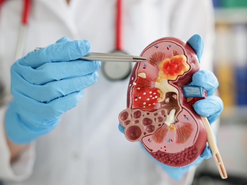 Urologia